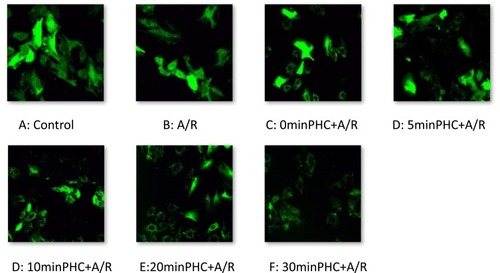 Figure 10 MPTP activity observed by confocal microscopy and with fluorescent staining technique. A/R promotes MPTP opening, and PHC attenuated MPTP activity.