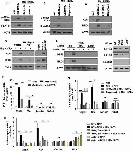 Figure 8. EGFR-PI3K-HIPPO axis regulates angiogenesis markers during mycobacterial infection. (A) Murine peritoneal macrophages were pre-treated with gefitinib and AG1478, followed by 1 h infection with Mtb H37Rv. Whole cell lysates were assessed for the activation of the indicated HIPPO pathway components by immunoblotting. (B) Peritoneal macrophages were pre-treated with LY294002 (PI3K and PtdIns3K inhibitor) or rapamycin (MTOR inhibitor), followed by 1 h infection with Mtb H37Rv and assessed for the activation of Hippo pathway by immunoblotting. (C) Peritoneal macrophages were pre-treated with LY294002 or rapamycin, followed by 12 h infection with Mtb H37Rv and assessed for the expression of KLF5 and BRD4 by immunoblotting. (D) RAW 264.7 macrophages were transfected with the indicated constructs (PIK3R/p85 DN, PIK3C/p110 OE) and transfected cells were infected with Mtb H37Rv for 12 h. Whole cell lysates were assessed for the expression of KLF5 and BRD4 by immunoblotting. (E) Peritoneal macrophages were transfected with Stk4 and Stk3 siRNA, Lats1 siRNAs or NT siRNA for 24 h followed by 12 h infection with Mtb H37Rv; and assessed for (E, left panel) the protein levels of KLF5, BRD4; and (E, right panel) knockdown of Stk4, Stk3 and Lats1, by immunoblotting. (F) The expression of the indicated angiogenic genes was analyzed in the murine peritoneal macrophages pre-treated with gefitinib for 1 h and followed by 12 h infection with Mtb H37Rv. (G) Peritoneal macrophages were pre-treated with LY294002 or rapamycin, followed by 12 h infection with Mtb H37Rv and assessed for the expression of the indicated angiogenesis genes by qRT-PCR. (H) Peritoneal macrophages were transfected with Stk4 and Stk3 siRNA, Lats1 siRNA or NT siRNA for 24 h followed by 12 h infection with Mtb H37Rv; and assessed for the expression of angiogenesis genes by qRT-PCR. All qRT-PCR data represents mean±S.E.M. and immunoblotting data is representative of three independent experiments. NT, non-targeting; Med, medium; DN, dominant-negative; OE, overexpression; *, p < 0.05; **, p < 0.005; *** p < 0.001; ns, not significant (one-way ANOVA in F-H; GraphPad Prism 5.0); ACTB was utilized as loading control.