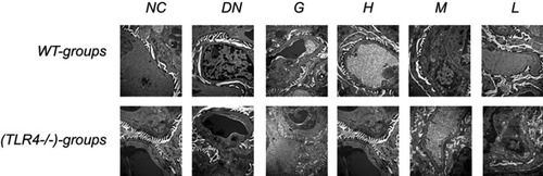 Figure 7 Effect of DMDD on the ultrastructural changes in the renal tissue of WT and KO mice. NC: normal control, DN: diabetic nephropathy group, G: gliquidone group (10 mg.kg−1.d−1), H: high dosage of DMDD group (50 mg.kg−1.d−1), M: medium dosage of DMDD group (25 mg.kg−1.d−1), L: low dosage of DMDD group (12.5 mg.kg−1.d−1).