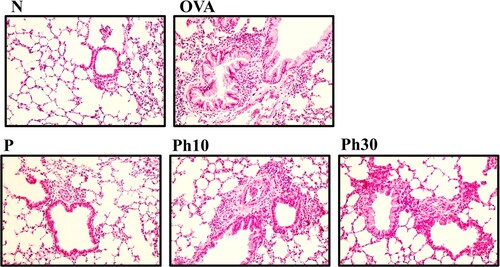 Figure 4. Effects of phillyrin (Ph) on eosinophil infiltration in lung tissue. Lung sections were stained using haematoxylin/eosin (H&E) staining. N, Normal group; OVA, OVA-induced asthma group; Ph10, group treated with 10 mg/kg phillyrin; Ph30, group treated with 30 mg/kg phillyrin; P, group treated with 5 mg/kg prednisolone.