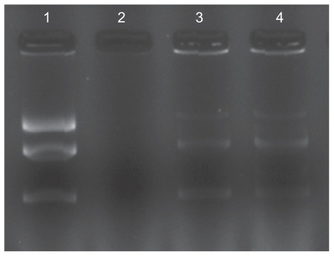 Figure 5 Protection and release assay of DNA. Lane 1 represents naked DNA(pEGFP-C1); lane 2 represents naked DNA treated with DNase I; lane 3 represents folic acid-conjugated stearic acid-grafted chitosan copolymer/DNA complex; lane 4 represents folic acid-conjugated stearic acid-grafted chitosan copolymer/DNA complex treated with DNase I.