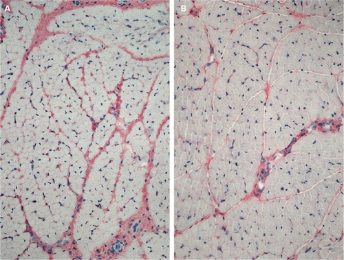 Figure 2 More intense antibody reaction (APAAP) for collagen I in the peri- and endomysium of M. gastrocnemius (A) in comparison with M. quadriceps femoris (B).