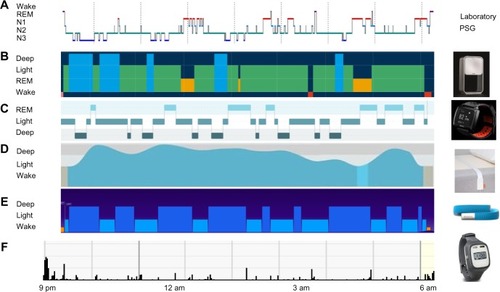 Figure 1 Comparison of sleep architecture across monitoring modalities.