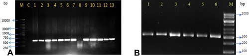 Figure 2 Gel electrophoresis analysis; (A) blaKPC gene (638bp); M 100 bp DNA ladder; C: Negative control; lane 1: Positive control; Lanes: 2, 3, 4, 5, 6, 7, 9, 10, 11, 12, 13: positive isolates for blaKPC gene with specific amplicon size 638 bp; Lane 8: negative isolate. (B) blaGES gene (323 bp); M 100 bp DNA ladder; lane 1: Positive control; Lanes: 2–6 positive isolates for blaGES gene with specific amplicon size 323 bp.