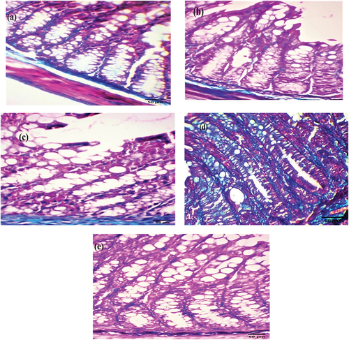 Figure 4. Photomicrograph of colorectal section post-6 weeks through mucosa layer showing (a) EDTA group, (b) DMSO group, and (c) Nic group with moderate collagen deposition, (d) DMH group with strong collagen deposition, and (e) Nic-DMH group with mild collagen deposition (Masson’s trichrome staining, scale bar: 50 µm).