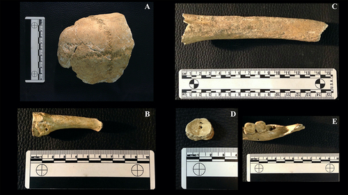 Figure 5. Detail photographs of bone elements recovered from the necropolis of San Bartolomé de Rebordáns (Tui, Pontevedra). A = fragment of the skull of individual NSBR16-IND6 relating to both parietal bones and the frontal bone. The metopic suture (metopism) can be seen; B = left third metatarsal of individual NSBR16-IND4 where a foramen or hole can be seen which could have been caused by an infection; C = fragment of left tibia of individual NSBR16-IND3 altered by taphonomic changes; D = fragment of the base of the proximal articular zone of the right proximal phalanx where a possible case of osteochondritis dissecans can be seen; E = detail of dental wear on the mandible of individual NSBR16-IND6.