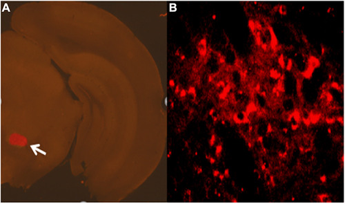 Figure 3 Expression of chemogenetic viruses in brain regions.