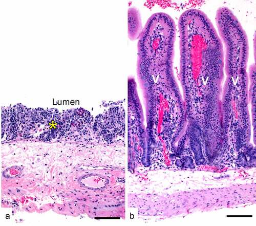 Figure 8. Effect of C. perfringens type F enterotoxin (CPE) on the small intestinal loops of a rabbit. A. CPE (50 micrograms) was injected into the lumen of a ligated small intestinal loop of an anesthetized rabbit. The animal was kept under anesthesia during 6 h after which it was euthanized and the intestinal loop was collected and processed for histology. There is almost complete loss of the mucosa (asterisk); no villi are observed. Scale bar = 100 μm. B. Normal control shown for comparison. This ligated small intestinal loop of the same rabbit was inoculated with buffer instead of CPE. Notice the intact mucosa with long villi (v). Scale bar = 70 μm. Hematoxylin and eosin