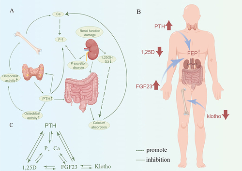 Figure 2 Mechanism of calcium and phosphorus imbalance in chronic kidney disease. (A) In the environment of chronic kidney disease, the decline of renal function leads to the dysfunction of P excretion and the increase of serum Pi level, and the decrease of 1.25(OH)2D3 secretion leads to the decrease of serum Ca level. At the same time, renal injury changes the intestinal microenvironment and reduces the absorption of Ca. In addition, in the environment of chronic kidney disease, hyperparathyroidism and increased PTH levels can not only promote the activity of osteoblasts and osteoclasts, thereby promoting calcification, but also increase the serum Pi level and promote changes in the intestinal microenvironment. (B) PTH, FGF-23, Klotho, and 1,25D have feedback loops to maintain calcium and phosphorus homeostasis. (C) In the environment of chronic kidney disease, the hormone levels of PTH, 1,25D and FGF-23 are dysregulated, thereby increasing the osteogenic activity of osteoclasts and promoting vascular calcification. Graphics by Figdraw.