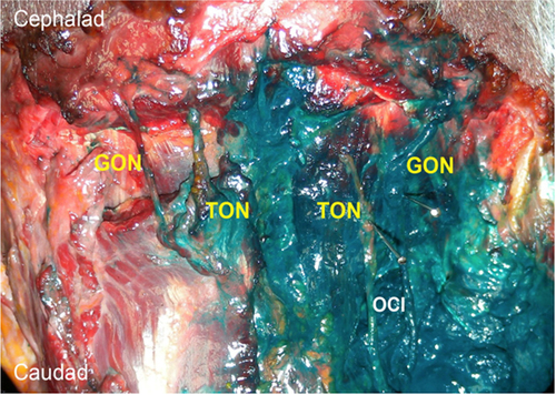Figure 2 Comparison of the dye-spreading patterns between GON block using 1 mL (left) and 5 mL (right) of dye solution.