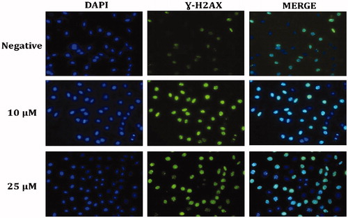 Figure 6. Representative DNA damage fluorescence microscopy images from cell treated with compound A1. A fragment of each cell was fixed and processed for γ-H2AX immunofluorescent staining. γ-H2AX staining is green; nuclei are stained with DAPI blue.