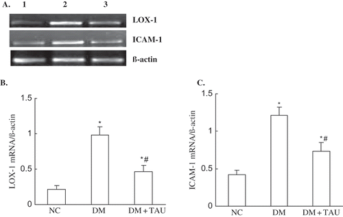 Figure 5. (A) RT-PCT analysis of LOX-1 and ICAM-1 mRNA, and (B and C) densitometric analysis in renal tissue in NC, DM, and DM +TAU rats. Lane 1 shows normal control, lane 2 shows DM, and lane 3 shows DM + TAU. Values are the mean ± SEM. *p < 0.01 vs. NC, #p < 0.01 vs. DM.