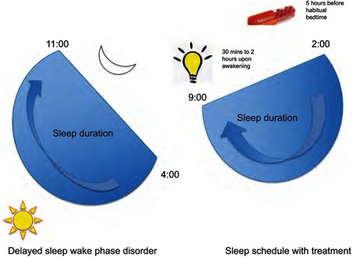 Figure 2 Management of delayed sleep–wake phase disorder.