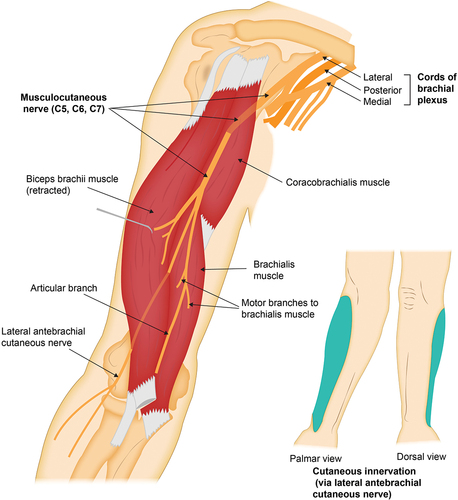 Figure 1. Origin and trajectory of the musculocutaneous nerve from the lateral cord of the brachial plexus to the lateral (radial) aspect of the forearm, with illustration of the main motor branches and cutaneous area of innervation in the lateral (radial) forearm (via its terminal branch, the lateral antebrachial cutaneous nerve).