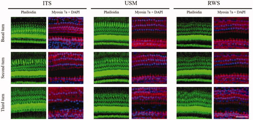 Figure 11. Representative images of confocal microscopic immunofluorescence analysis of cochlear surface preparation 28 days after USMB treatments. There was no difference in the survival of cochlear hair cells between the USM, RWS and ITS groups. The staining shows the nuclei (blue, DAPI), filamentous actin (green, phalloidin), and cell bodies (red, myosin 7a). Four repetitions of this experiments were conducted. Scale bar: 50 μm.
