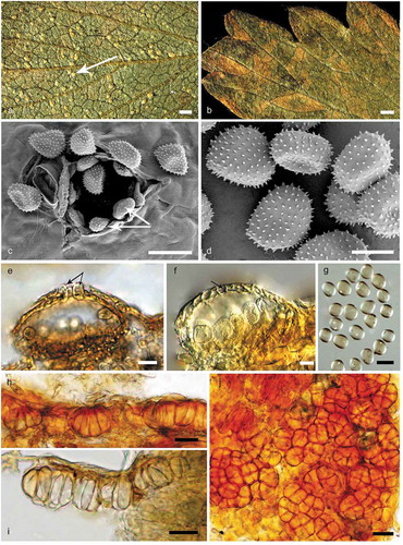 Figure 2. Morphological characters of Quasipucciniastrum agrimoniae. A: Uredinia (white arrow) on the hypophyllous leaf surface. B: No uredinia and telia on eiphyllous leaf surface. C: Uredinium with echinulate ostiolar cells (white arrow) observed by SEM. D: Urediniospores with echinulate spines observed by SEM. E: Uredinium with well-developed ostiolar cells (black arrow) observed by LM. F: Uredinium with peridium cell (black arrow). G: Urediniospores observed by LM. H: Vertical section of hypophyllous telia. I: Subepidermal teliospores with apparently thickened apical wall. J: Subglobose teliospores with vertical or oblique septa. Bars: A, B = 0.6 mm; C, E, G, H, I, J = 20µm; D, F = 10µm.