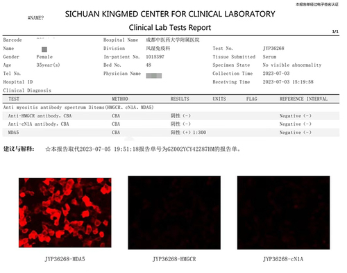 Figure 1 Myositis-specific antibody profile report.