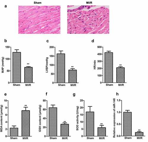 Figure 1. Comparison of cardiac dysfunction related index in MI/R group and sham group. (a) Pathological injury was measured by HE staining (×200). (b) MAP value. (c) LVSP value. (d) HR value. (e) The content of MDA. (f) The content of GSH. (g) The content of SOD. (h) Relative expression of miR-148 in MI/R group and sham group was measured by qPCR. The data is shown as means ± SD, **P < 0.01 vs. Sham group