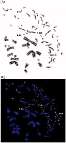 Figure 7. G0-lymphocyte PCC visualized by means of inverted grey scale mode (ISIS-FISH software, MetaSystems) following a 24 h post-irradiation repair period showing two possible dicentric chromosomes (A). True dicentric chromosomes (T dic) can be detected accurately only by means of C/T FISH staining with PNA probes (B). The presence of telomeric staining (Tel-FAM, green) between the two centromeres (Cent-Cy3, red), as shown in this Figure (B), confirms undoubtedly a false dicentric (F dic).