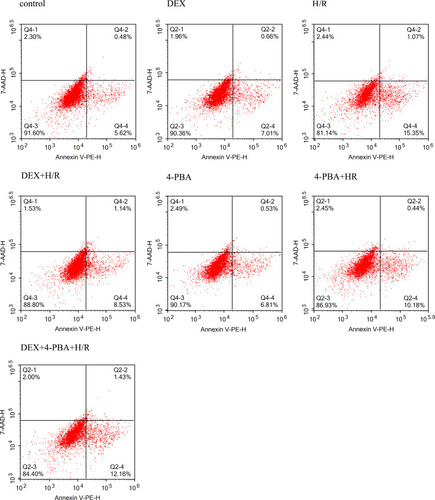 Figure 2 The percentages of apoptotic H9C2 cardiomyocytes were examined by flow cytometry under different conditions.