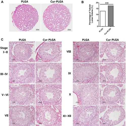 Figure 4 Disrupted structure of seminiferous epithelia by Cur-PLGA-NPs treatment. (A) Representative macroscopic images of testicular sections. Bar = 500 μm.(B) Relative volume (%) of tubular lumen. **P< 0.01.(C) Morphologic changes in different stages during spermatogenesis. Bar = 50 μm.