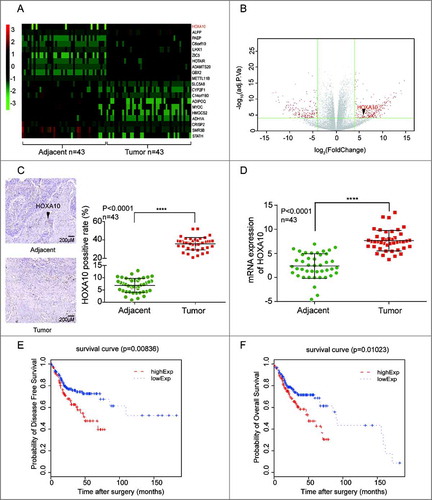 Figure 1. HOXA10 was overexpressed in HNSCC. (A) HOXA10 expression in 43 tumor samples relative to the corresponding normal tissues. (B) The expression quantity of HOXA10 in the tumor tissues was about 6.87 times higher than that in the paired normal tissues. (C) The expression of HOXA10 protein in tumor tissues was significantly higher than that in tissues adjacent to cancer (****P<0.0001, n = 43, compared with tumor adjacent group). (D) The expression level of mRNA of HOXA10 in the tumor tissues was higher than that in tissues adjacent to cancer (****P<0.0001, n = 43, compared with tumor adjacent group). (E-F) According to the analysis to 291 HNSCC cases in TCGA data base, the overall survival of low HOXA10 expression patients (P = 0.01023, compared with low HOXA10 expression group) and disease-free survival (P = 0.00836, compared with low HOXA10 expression group) of low HOXA10expression was better than that of high HOXA10 expression.