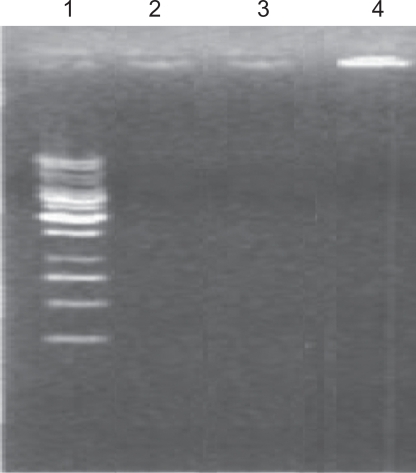 Figure 4 Electrophoresis of simple GAPDH AS-ODN (second track), nonaldehyde Fe3O4-dextran-anti-β-HCG-GAPDH AS-ODN (third track), and aldehyde Fe3O4-dextran-anti-β-HCG-GAPDH AS-ODN (fourth track) that has been digested by DNase I.Abbreviations: GAPDH, glyceraldehyde-3-phosphate dehydrogenase; AS-ODN, antisense oligodeoxynucleotides; Fe3O4, magnetic iron oxide; HCG, human chorionic gonadotropin; DNase I, deoxyribonuclease I.