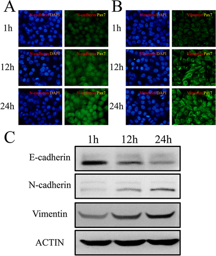 Figure 6 The expression of epithelial and fibroblast markers in TU686 cells (25 mM BLM incubation). Immunofluorescence staining was used to analyze the expression of (A) N-cadherin and (B) vimentin in TU686 cells after 1h, 12h and 24h of differentiation. (C) Expression of E-cadherin, N-cadherin, vimentin and ACTIN after 1h, 12h and 24h of TU686 cell differentiation was detected by immunoblotting. ACTIN was used as an internal control.