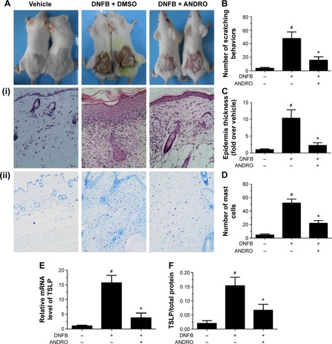 Figure 5 ANDRO improved the clinical symptoms in DNFB-induced AD mice via local administration.
