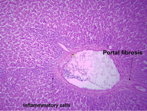Figure 5. Liver of –MOS −AF group of 42-day-old broiler chickens showing moderate portal inflammatory cell infiltration beside portal fibrosis (H&E × 250).