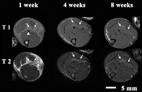 Figure 3. Time course of T1 and T2 signals after crushing of soleus muscle. Axial scans of the left lower leg of rat 2 in the MRI group, 1, 4, and 8 weeks after trauma. The asterisk shows the tibia and the arrowhead shows the fibula. Arrows: soleus muscle.