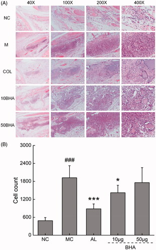 Figure 5. (A) Histopathological assessment of synovium in ankle joints of rats after H&E staining. The right ankles of mice were excised and fixed in 4% paraformaldehyde, and subsequently decalcified using 10% ethylenediaminetetraacetic acid. They were then dehydrated via processing in alcohol/xylene mixtures with different proportions and concentrations. The histological sections were stained with hematoxylin and eosin. The histopathological changes of the joint synovium were assessed for the degree of inflammatory cell infiltrate, by an experienced histopathologist. Microscopy at magnifications of 40×, 100×, 200× and 400× is shown for typical areas for each of the five groups. Normal rats (NC), displayed normal synovium. Increased inflammatory cell infiltration was noted in the synovium of MSU crystal-injected rats (MC). Treatment with COL, and 10 µg of BHA partially prevented the pathological changes seen in the MSU crystal-injected rats. (B) Quantification of the pro-inflammatory cells. Data are expressed as mean ± S.D. (n = 5), ###p < 0.001 relative to NC group (n = 5); *p < 0.05 and ***p < 0.001 relative to MC group.