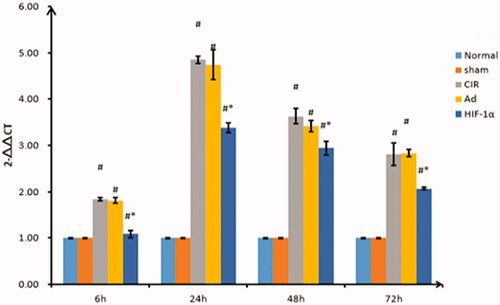 Figure 4. Relative quantification of caspase-3 expression by qRT-PCR at different reperfusion time points. qRT-PCR was used to detect the expression of caspase-3. Data are presented as mean ± SD. *p < 0.01 vs. CIR and Ad groups, #p < 0.01 vs. normal and sham groups.