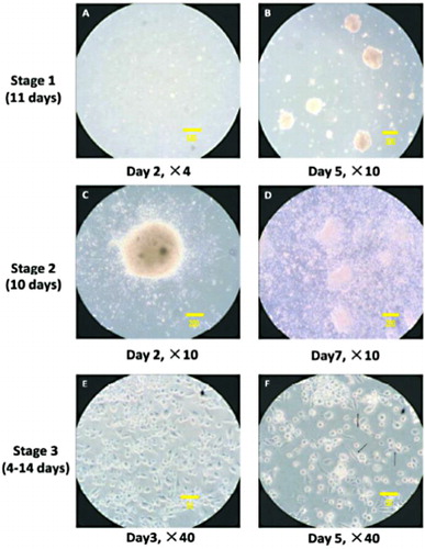 Figure 1. Cellular morphology variation during the procedure of differentiation. The differentiation procedure included three stages. Stage 1: Cells were suspension cultured for 11 days. (A): Stage 1, day 2. (B): Stage 1, day 5. EBs formed (white arrow). Stage 2: EBs were adherently cultured for 10 days. (C): Stage 2, day 2. Cells grew radially. (D): Stage 2, day 7. Cells proliferated. Stage 3: Cells were adherently cultured for 4–14 days. (E): Stage 3, day 3. (F): Cells grew into alveolar type II epithelium-like cells (black arrow). 550 × 750 mm (200 × 200 DPI). ×4: scale bar, 500 μm. ×10: scale bar, 200 μm. ×40: scale bar, 50 μm.