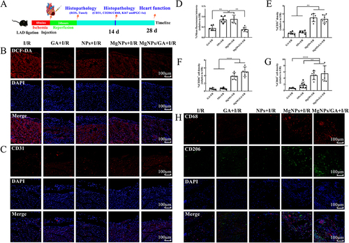 Figure 7 Immunofluorescence staining of histopathological sections after I/R animal model. (A) Schematic diagram of the establishment of the I/R mouse model and protocol for evaluating therapeutic effects. (B) Detection of reactive oxygen species in the region of injured myocardium 24h after I/R in mice, scale bar: 100µm. (C) Detection of Angiogenesis in Areas of Injured Myocardium 14 Days After I/R in mice, scale bar: 100µm. (D) Quantitative analysis of ROS fluorescent probe staining of histopathologic sections. (E) Quantitative analysis of CD31 immunofluorescence staining of histopathological sections. (F–H) The number of M2 macrophages in the region of injured myocardium was detected and quantitatively analyzed 14 days after I/R in mice, scale bar: 100µm. Results are presented as mean ± SD (N = 6), **P < 0.01, ****P < 0.001.