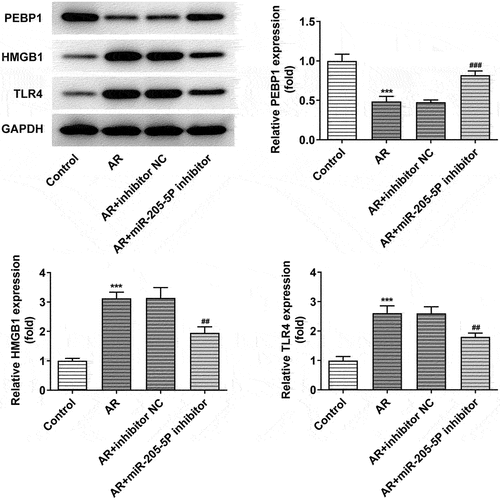 Figure 4. miR-205-5P inhibitor increased decreased PEBP1 expression and the expressions of HMGB1/TLR4. ***P < 0.001 versus control group, ##P < 0.01, ###P < 0.001 versus AR + inhibitor NC.