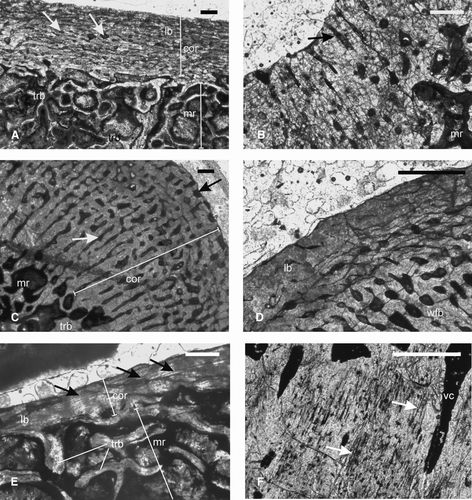 FIGURE 6 Paracyclotosauridae. A–B, ISIA181/9, tibia showing A, a narrow cortex composed of lamellar bone surrounding a large medullary region. Note the presence of bony trabeculae in the medullary region. Arrows indicate longitudinally oriented vascular channels. B, radially arranged vascular channels (arrow) at the cnemial crest; C–D, ISIA181/10, rib showing C, a thick compact cortex surrounding the medullary region. Black arrow indicates the irregular periosteal periphery. White arrow indicates radial channels in the deeper cortex. D, peripheral lamellar bone and woven fibered bone in the deeper cortex. E, ISIA181/11, intercentrum showing a compact cortex containing avascular lamellar bone and three LAGs (arrows), surrounding a medullary region. Note the presence of bony trabeculae of the cancellous bone in the medulla. F, ISIA181/12, intercentrum showing Sharpeys’ fibers (arrows) and radially arranged vascular channels in the cortex. All figures are of transverse sections. Scale bars equal 300 μm.