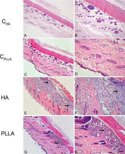 Figure 2 Photomicrograph of dermal skin biopsies after 15 days of dermal injection of PBS (control for HA: A and B), distilled water (control for PLLA: C and D), HA (E and F), and PLLA (G and H). Arrows indicate the presence of dermal filler. Scale: (A, C, E and G)= 500 μm; (B, D, F and H)= 200 μm.