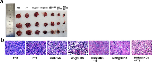 Figure 11 (a) Images of tumors at 13 days post-treatment; (b) HE stains of tumors at 13 days post-treatment.