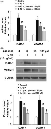 Figure 4. Paeonol inhibits the expression of adhesion molecules. ATDC5 cells were incubated with 10 ng/mL IL-1β with or without paeonol (50, 100 μM) for 24 h. (A) mRNA levels of ICAM-1 and VCAM-1; (B) Protein levels of ICAM-1 and VCAM-1 (*, #, $, P < .01 vs. previous control group).