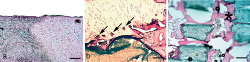 Figure 2. Histology of an osteochondral defect 12 weeks after insertion of the bioimplant. Hematoxylin-eosin staining. A. Regenerate 12 weeks after implantation of the bioimplant. The surface is mainly even, with a little step in the transition zone to normal cartilage (at the left). Bar represents 220 μm. B. Higher-power image of a cartilage regenerate. The rest of the polyglactin/polydioxanon is still visible (arrow). Bar represents 200 μm. C. Higher-power image of the bone replace ment Bar represents 90 μm.