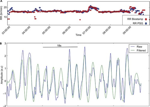 Figure 1 Respiration measurements.