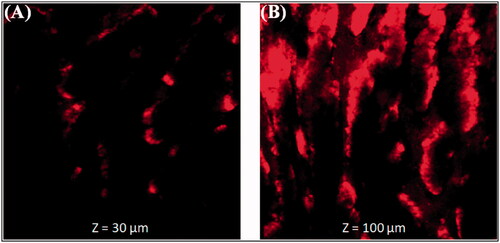 Figure 6. Permeation depth image (A). Thymoquinone suspension (THQ-S) (B). Optimized thymoquinone chitosan-polycaprolactone nanoparticles (THQ-CPLNPs).