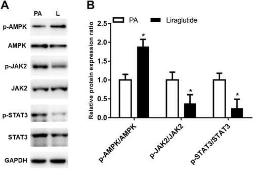 Figure 5 Liraglutide regulated the activity of AMPK and the JAK2/STAT3 signaling pathway. (A) Western blot results for activity of AMPK and the JAK2/STAT3 signaling pathway. (B) Liraglutide intervention in adipocytes resulted in the activation of AMPK and deactivation of the JAK2/STAT3 signaling pathway. *P < 0.05.