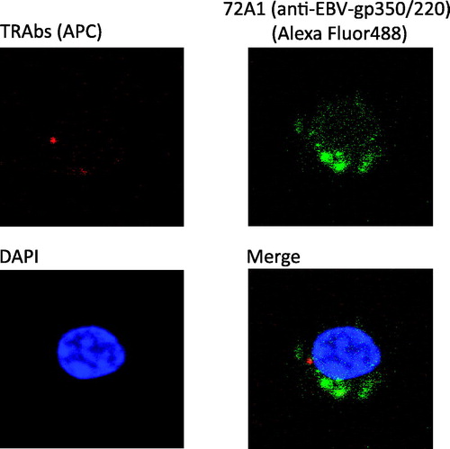 Figure 2. TRAb(+) 72A1(+) cells had characteristics of antibody-producing cells. TRAb(+) 72A1(+) cells were sorted and observed through a confocal laser microscope. Red spots of APC representing TRAbs were observed inside the cells, and green signals of Alexa Fluor488 representing 72A1 were detected inside or on the surface of the cells. The cytoplasm was abundant, and the nucleus was slightly deformed.