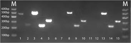 Figure 2 The virulence genes of three isolates. 1–5 represent rmpA2, iucA, peg-344, iroB, and rmpA, respectively, from the father’s stool sample, and 6–10 represent rmpA2, iucA, peg-344, iroB, and rmpA, respectively, from the infant’s stool isolate. 11–15 represent rmpA2, iucA, peg-344, iroB, and rmpA, respectively, from the infant’s CSF isolate. M represents the marker.