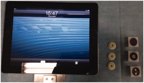 Figure 1. Components of the navigation system: a tablet device (iPad 2® Apple Inc., CA, USA), CT-compatible markers, and plastic marker caps.