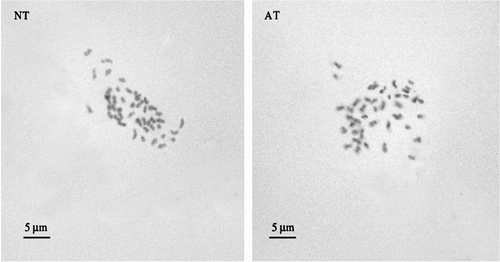 Figure 5 Metaphase plate from normal type (NT) and albino type (AT) obtained from cytogenetic analysis of Erythrina crista-galli root meristem.