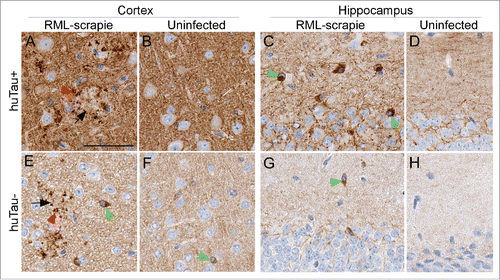 FIGURE 5. Immunohistochemical analysis of pS396 tau in huTau+ and huTau− mice. All brain tissues from scrapie-infected mice were obtained at the time of clinical disease. Brain region and infection status are shown across the top of the figure. The top row shows huTau+ mice, the bottom row shows huTau− mice. Black arrows indicate examples of PrPSc plaques, red arrowheads show plaque-associated P-tau, and green arrowheads show intracellular P-tau staining. The scale bar in A is 50 µm and applies to all panels.