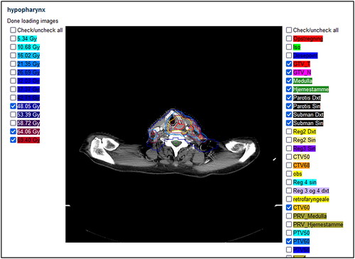 Figure 6. The RT plan viewer.